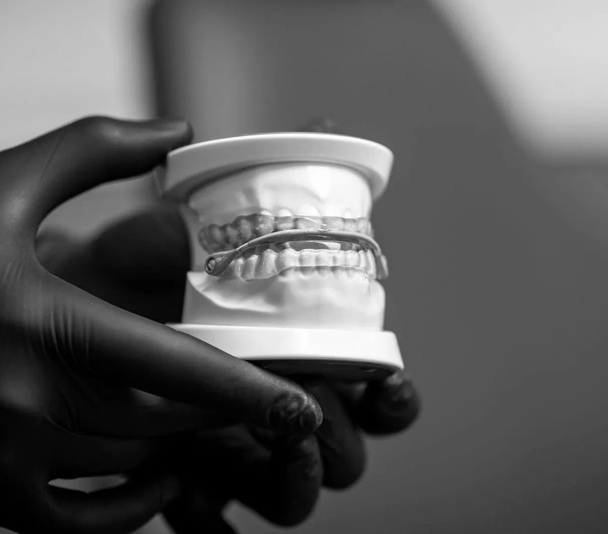 Dental model fitted with a custom oral appliance at Dental.Affect